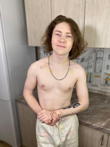 Free skip_london